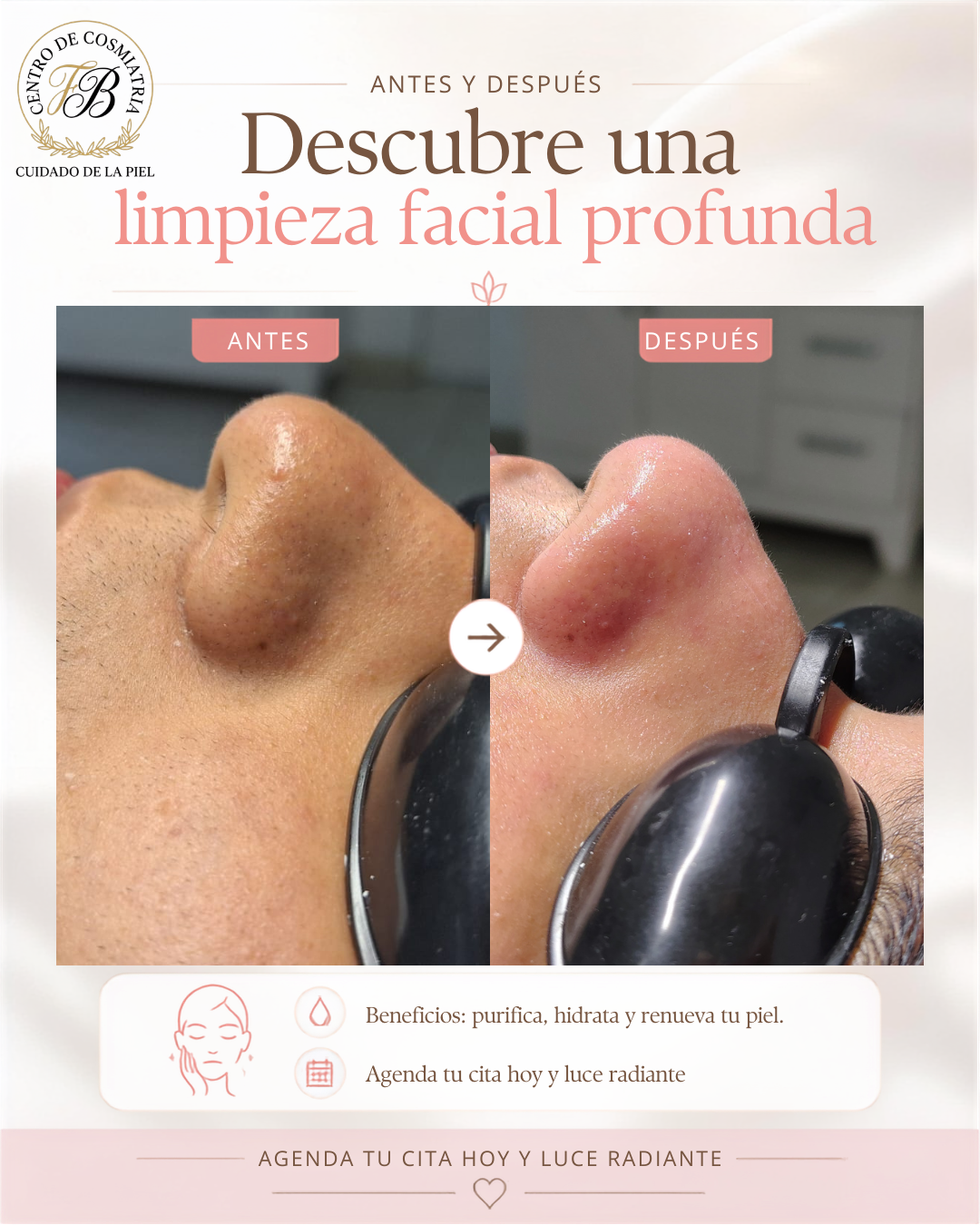 Antes Tratamiento Facial